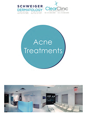 Acne Treatments Guide
